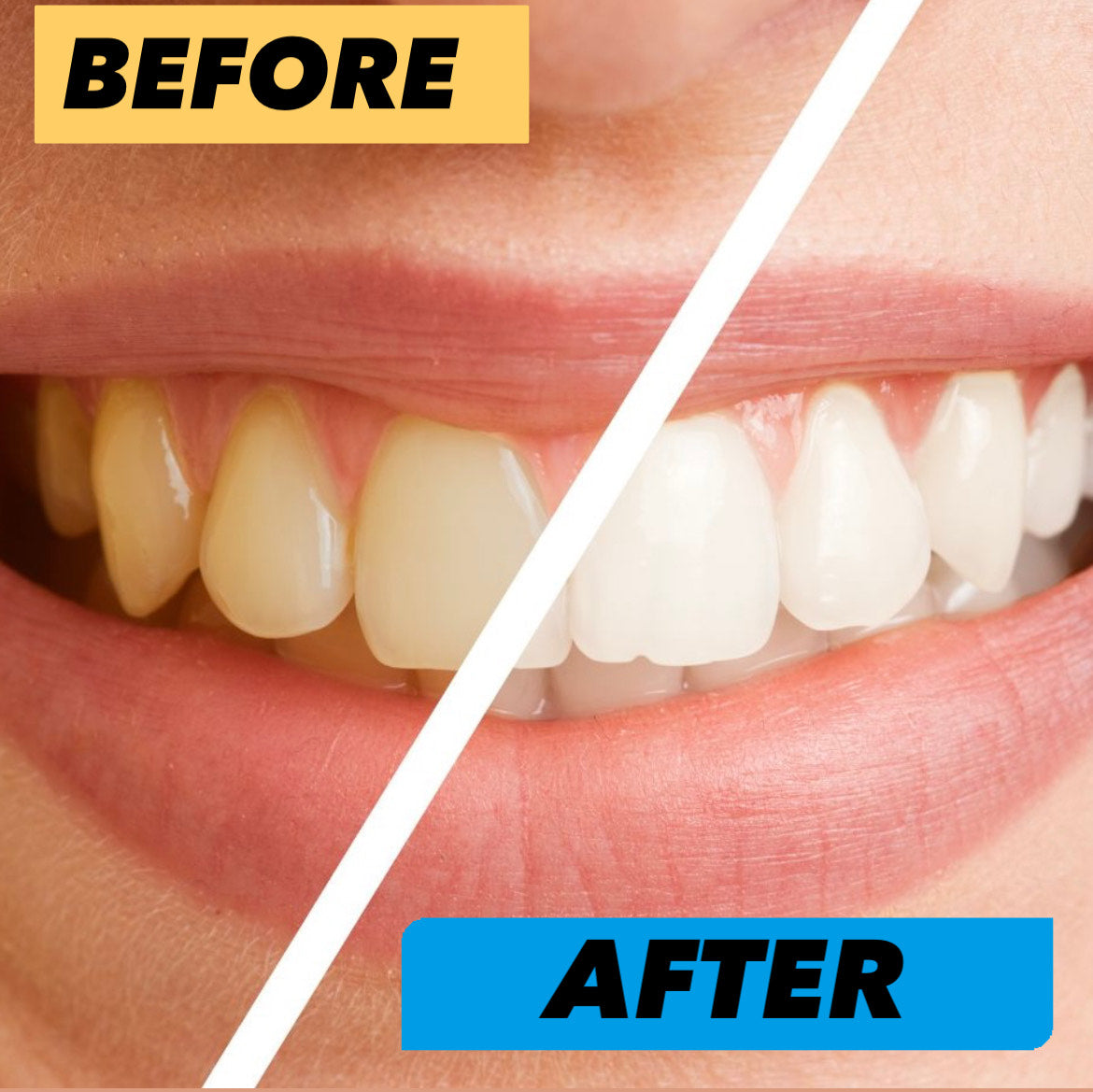 Luxury MR. White Whitening Toothpaste™